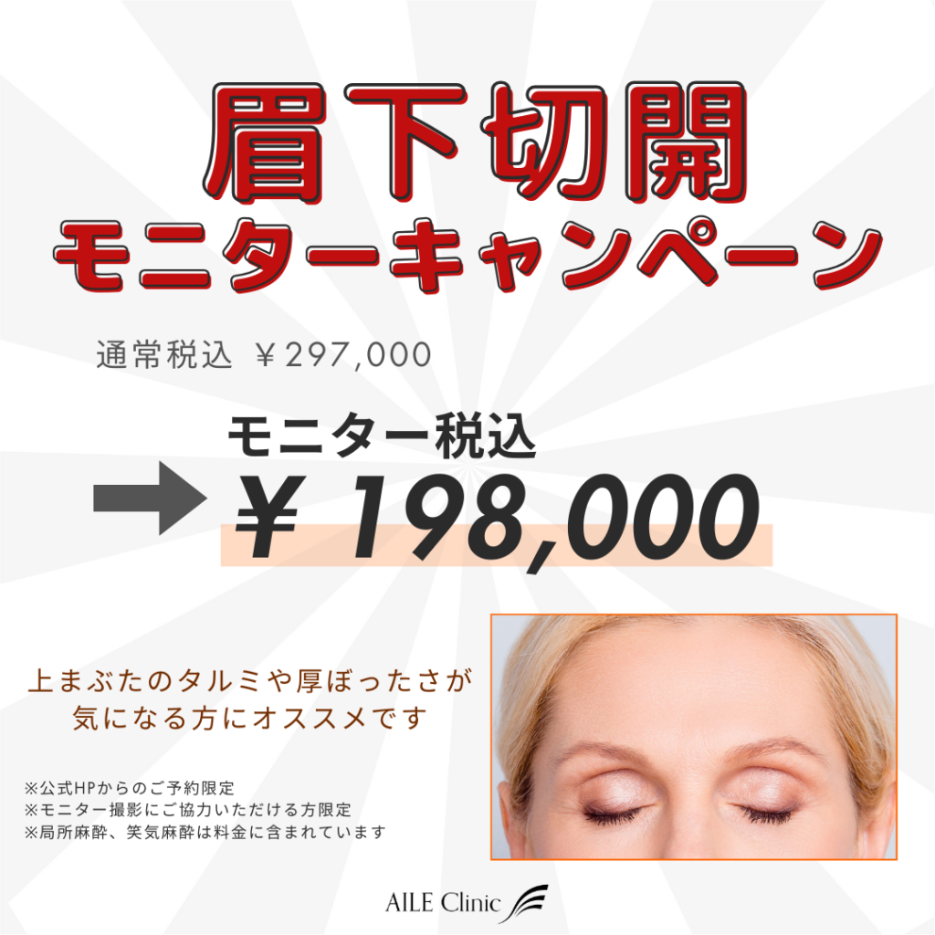 眉下切開キャンペーン