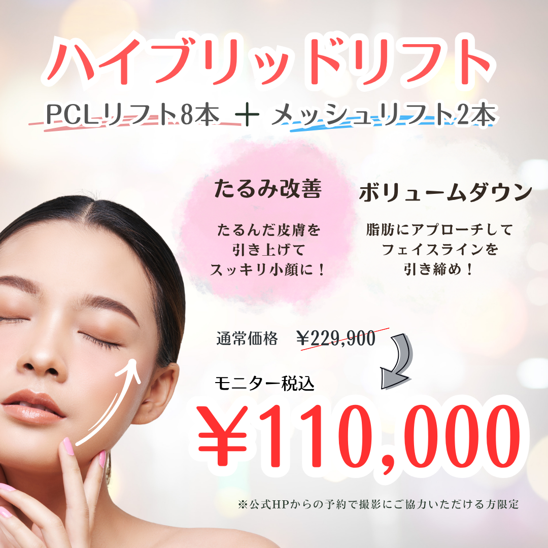 ハイブリッドリフトモニターキャンペーン